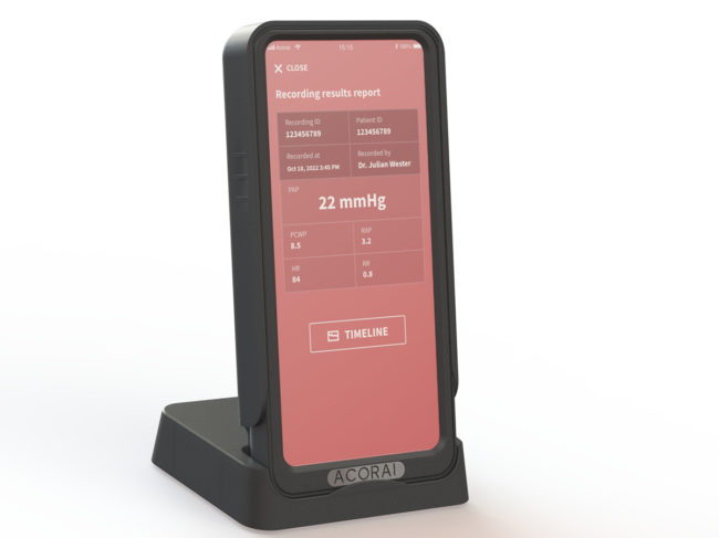 Acorai Heart Monitor