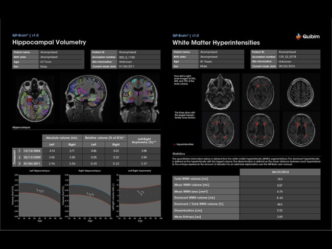 QP Brain analysis software