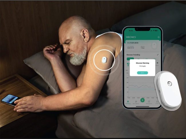 sibionics cgm