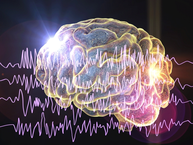 Brain and encephalography