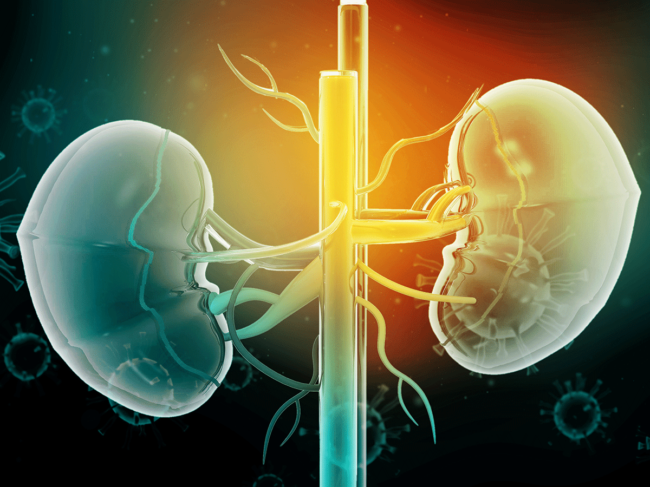 Kidney disease illustration