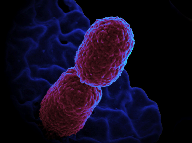 Klebsiella pneumonia