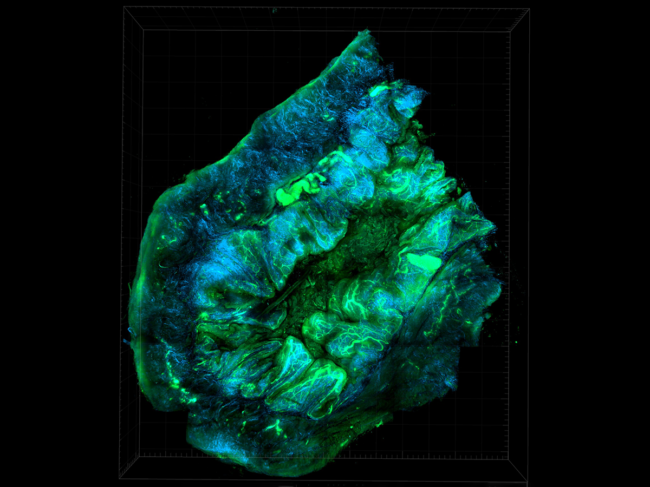 Mouse model of ovarian cancer.