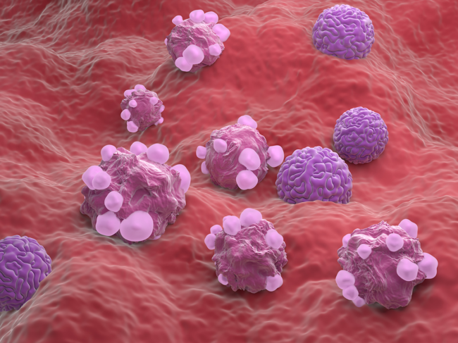 3D illustration of ovarian cancer cells