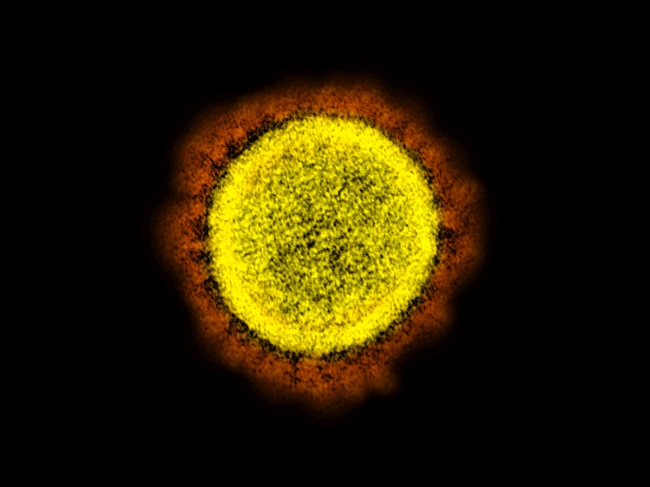 SARS-CoV-2 virus particles